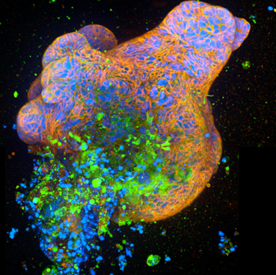 Milner collaboration develops organoid assays that could help identify new treatments for Crohn’s disease