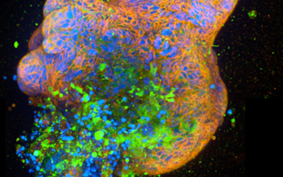 Milner collaboration develops organoid assays that could help identify new treatments for Crohn’s disease